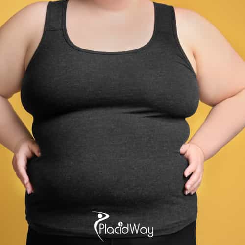 8 Recovery Tips for American Patients Undergoing Duodenal Switch in Piedras Negras